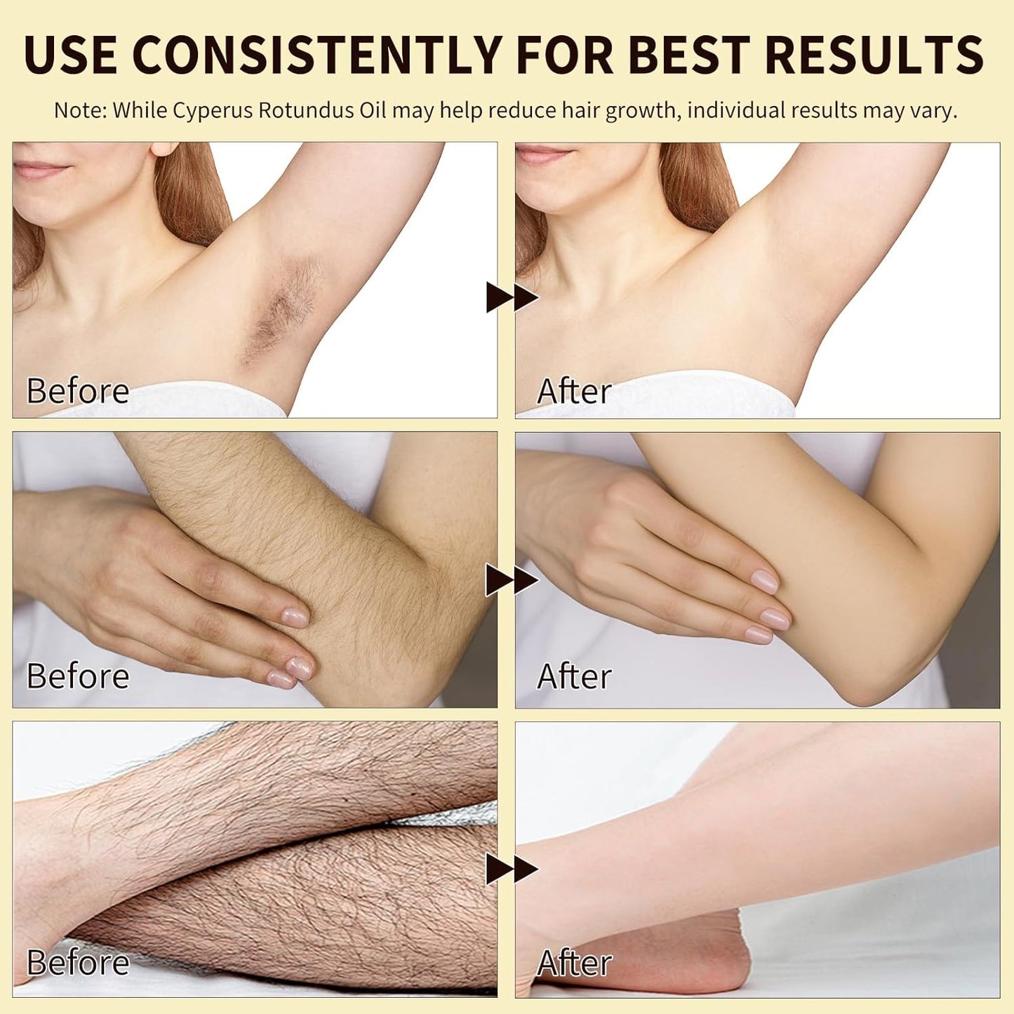 BareBloom™ – Cyperus Rotundus Oil