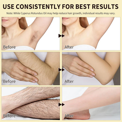 BareBloom™ – Cyperus Rotundus Oil